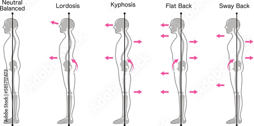 立ち姿勢評価分類　英語
