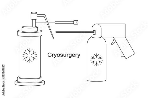 Cryo instruments for Cryosurgery vector line illustration. Liquid nitrogen cooling for cryogenic treatment. Ice therapy for benign and malignant lesions.