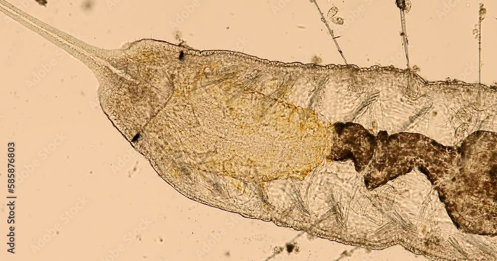 Stylaria lacustris (worm of the family Naididae) under the microscope ...