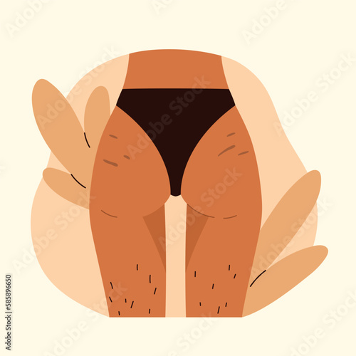 Woman's buttocks with stretch marks and hairy legs. Body positive,  love yourself, normalize female body hair, body care. Vector illustration in cartoon style. Isolated white background.