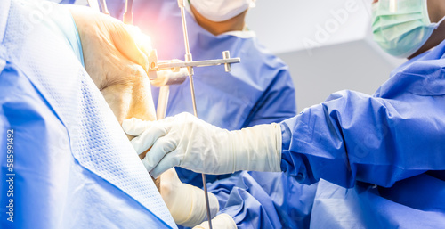 Hand of doctor or surgeon in blue gown inside operating room during osteomy in total knee joint replacement surgery.People did implant prosthesis arthroplasty in knee patient inside orthopedic unit