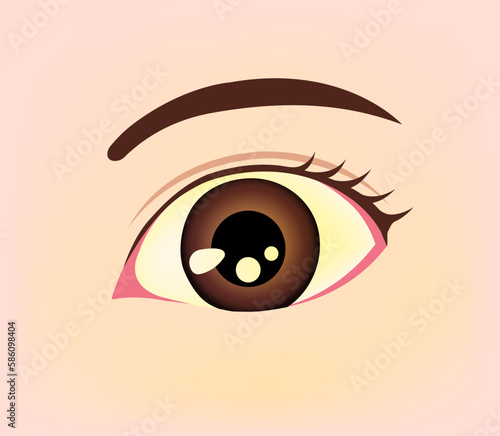 Jaundiced eye ( yellow eye ) vector illustration