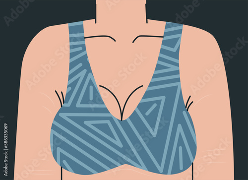 Big female bust in bra. Woman's body with stretch marks on her arms and chest. Upper female body in geometric print top. Vector trend illustration for design.
