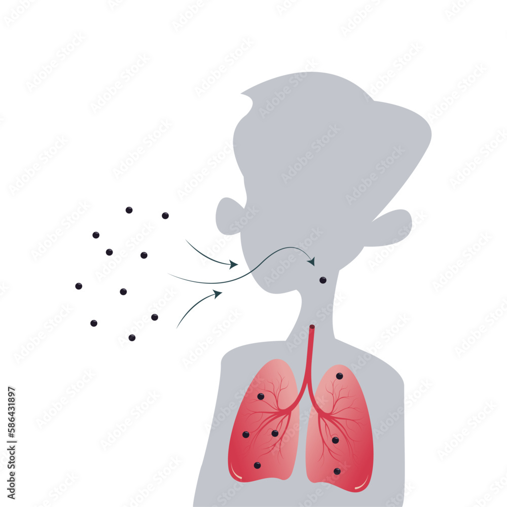 Inhaling germs into the lungs background vector illustration graphic Inhaling germs into the lungs background vector illustration graphic