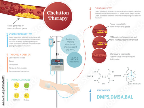 Infographic: Elimination of heavy metals and toxins in the blood by chelation treatment, explanation of the treatment in graphic form.