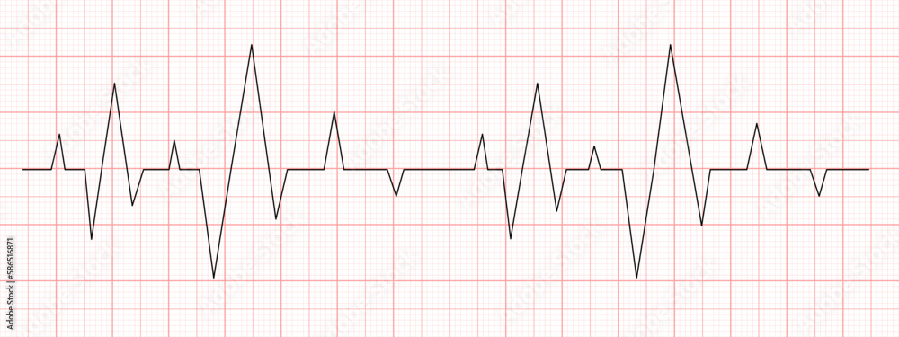 Black heart beat diagram on red graph paper. Electrocardiogram chart. Cardiac rhythm line. Cardio test sign. Cardiology hospital symbol