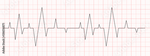 Black heart beat diagram on red graph paper. Electrocardiogram chart. Cardiac rhythm line. Cardio test sign. Cardiology hospital symbol