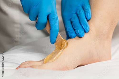 Hair removal process on female leg with epilation.