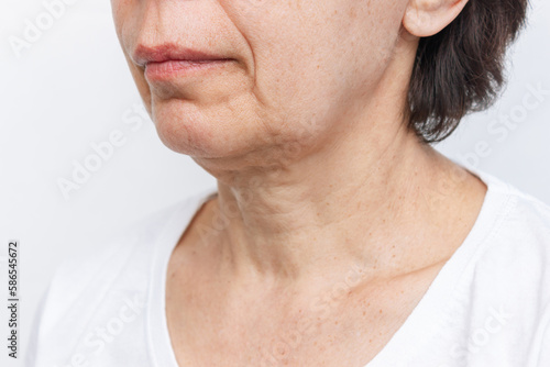 The lower part of elderly woman's face and neck with signs of skin aging on a white background. Age-related changes, flabby sagging facial skin. Cosmetology and beauty concept. Ageing