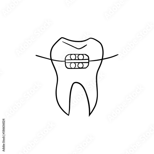 Vector illustration. Dentist's tools. Black outline on a white background. Tooth with bracket