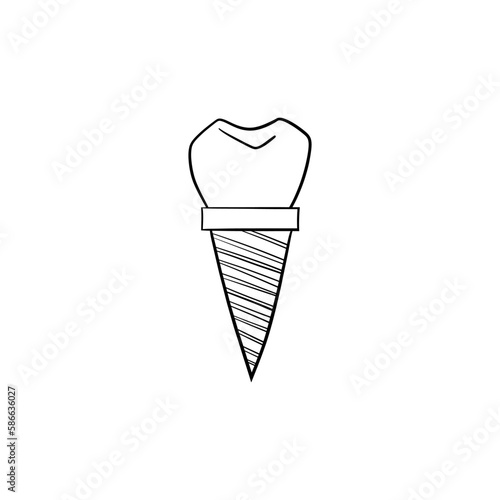 Vector illustration. Dentist's tools. Black outline on a white background. Dental implant.