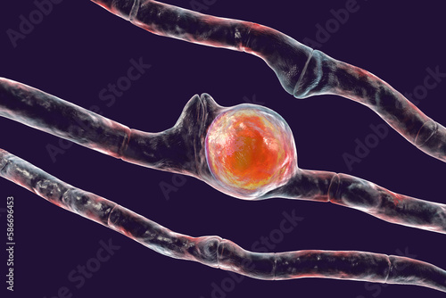 Basidiobolus ranarum microscopic fungi, 3D illustration. Cause chronic inflammatory subcutaneous mucormycosis
