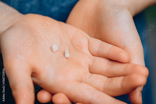 The child's hands holds the first fallen baby teeth in close-up. The concept of the dentistry and oral changes.