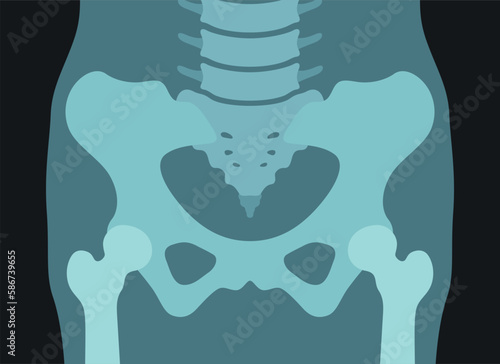 Pelvis x ray picture human anatomy skeleton bone scanning internal checkup radiology vector flat
