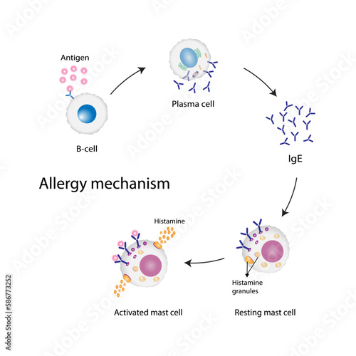Allergy mechanism. Anaphylactic reaction, allergic reaction, Autoimmune disorders, allergy and anaphylaxis. Mast cells, b cell, basophils and IgE antibodies are in involved in Anaphylactic reaction.. photo