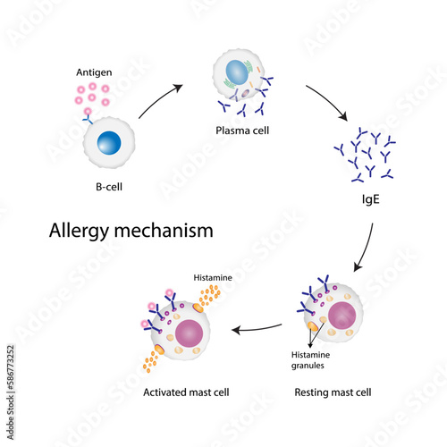 Allergy mechanism. Anaphylactic reaction, allergic reaction, Autoimmune disorders, allergy and anaphylaxis. Mast cells, b cell, basophils and IgE antibodies are in involved in Anaphylactic reaction..