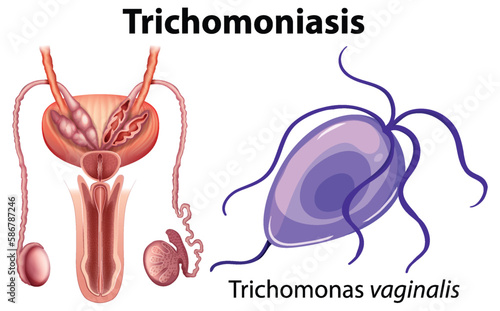 Trichomonas vaginalis on white background