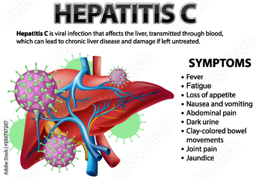 Explaining Hepatitis C with Vector Graphics