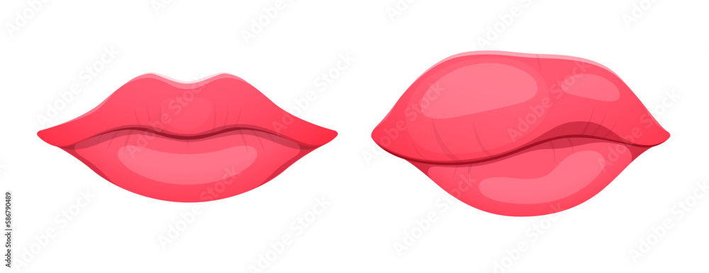 Angioedema or edema of lips. Body tissue swelling, allergic syndrome, dermatology edema disease or infection inflammation symptom, healthcare or medical problem concept with woman cartoon vector lips Angioedema or edema of lips. Body tissue swelling, allergic syndrome, dermatology edema disease or infection inflammation symptom, healthcare or medical problem concept with woman cartoon vector lips