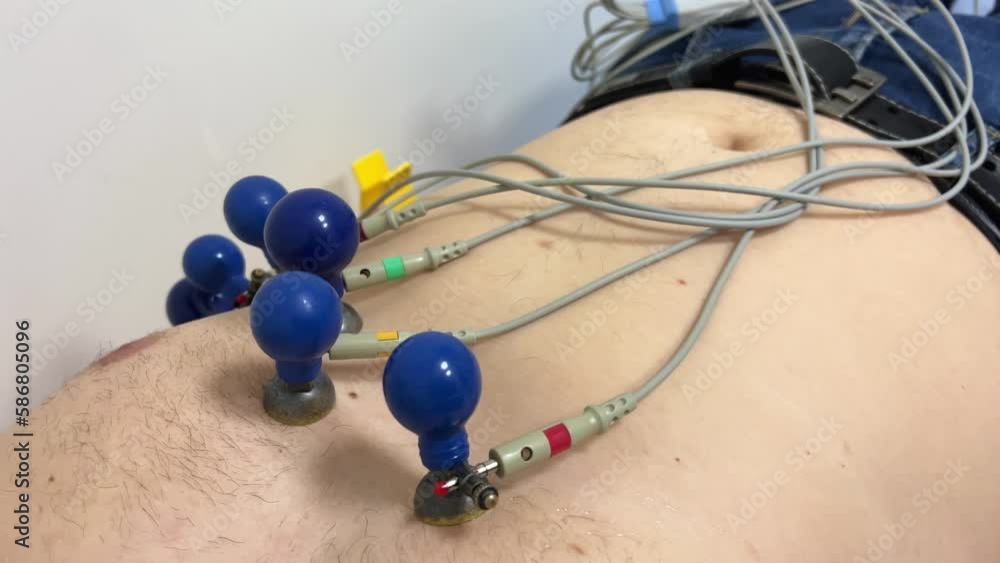 diagnoses heart disease cardiogram ECG or EKG of heart with electrodes