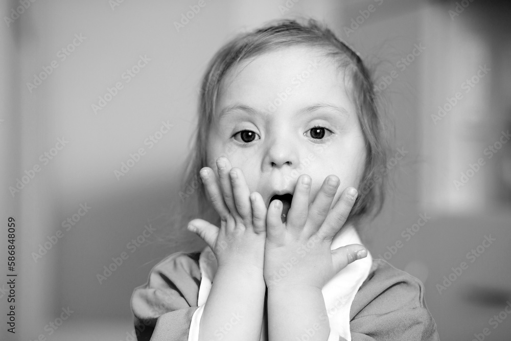 Portrait of a girl with Down syndrome. Black and white image. Close-up portrait of a child. The girl holds her hands near her face. Emotional photo.
Portrait of a girl with Down syndrome. Black and white image. Close-up portrait of a child. The girl holds her hands near her face. Emotional photo.
