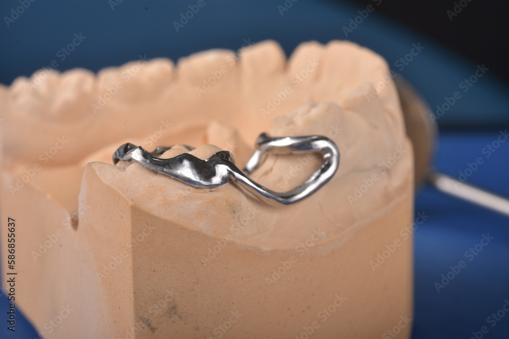 Maintaining proper spacing between teeth is crucial for a healthy and