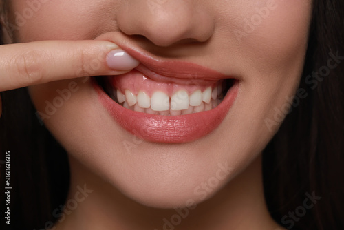 Young woman showing healthy gums  closeup view