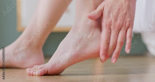 Asian woman touching cracked heels