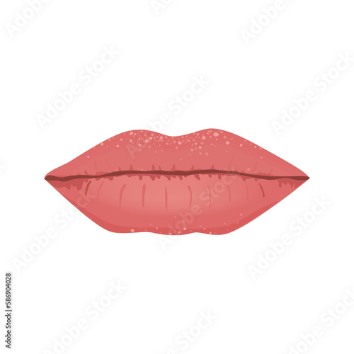 Fordyce Spots on Lips, Isolated Vector Illustration. Fordyce granules