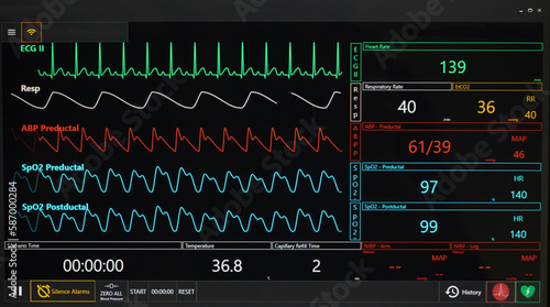 Control room of the pediatric resuscitation simulation course.