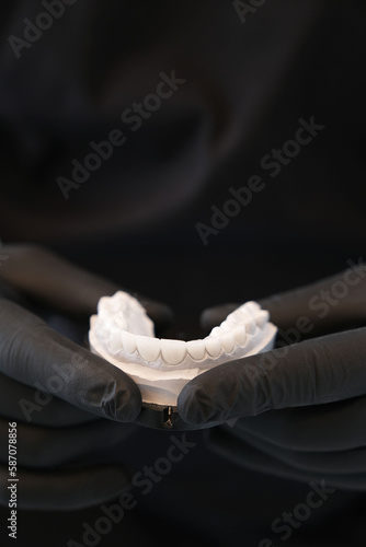 Dentist in black gloves holding white dental prosthesis. © yasin