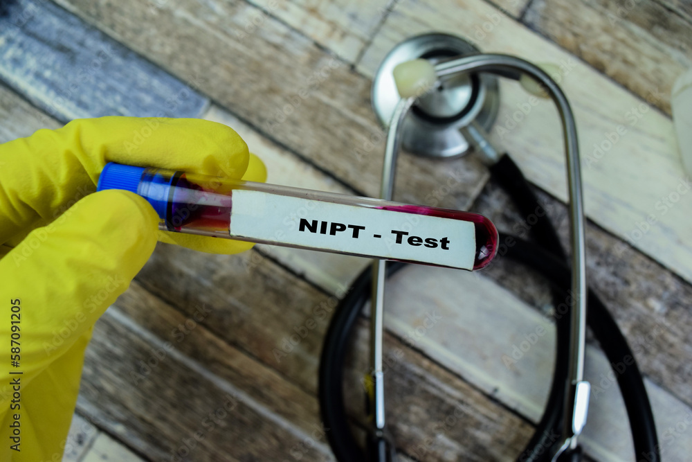 Concept of NIPT - Test with blood sample. Healthcare or medical concept Concept of NIPT - Test with blood sample. Healthcare or medical concept