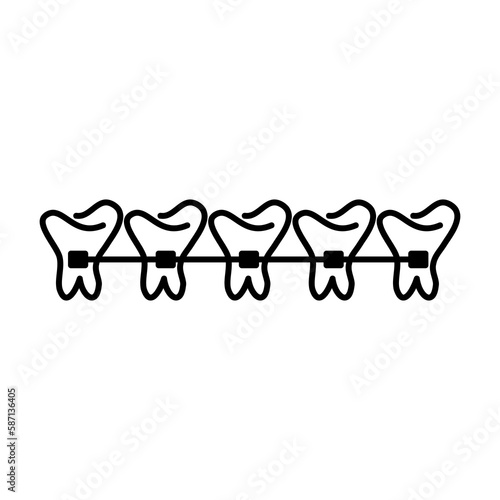 Lingual braces flat vector illuatration on white background..eps