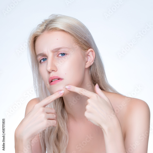 Фототапет Acne problem troubling closeup personable worried woman with natural beauty skin checking her face squeezing pimple spots in isolated background