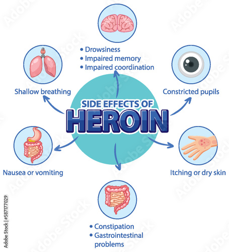 Human anatomy diagram cartoon style of Heroin side effects