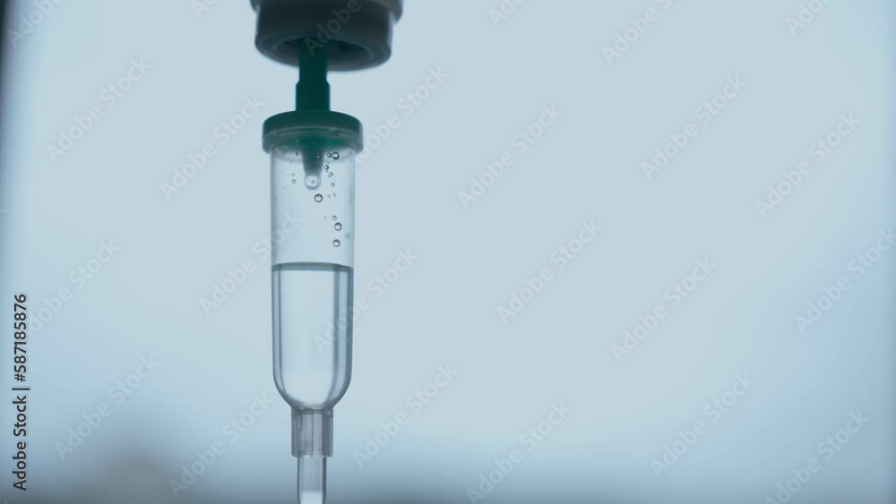 Close-up of the Infusion Process. Drop of Saline is Dripped for Intravenous Infusion IV During Chemotherapy. Close-up of the Infusion Process. Drop of Saline is Dripped for Intravenous Infusion IV During Chemotherapy.