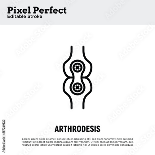 Arthrodesis joint surgery thin line icon. Arthritis. Pixel perfect, editable stroke. Vector illustration.