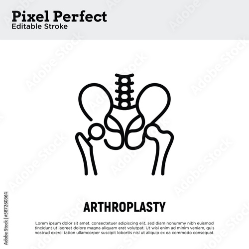Arthroplasty thin line icon, artificial joint, surgical procedure to restore joint. Arthritis. Pixel perfect, editable stroke. Vector illustration.