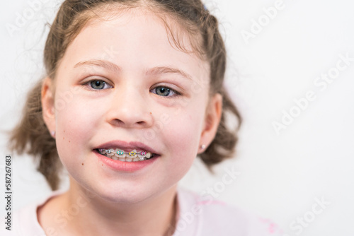 Little girl with rainbow braces