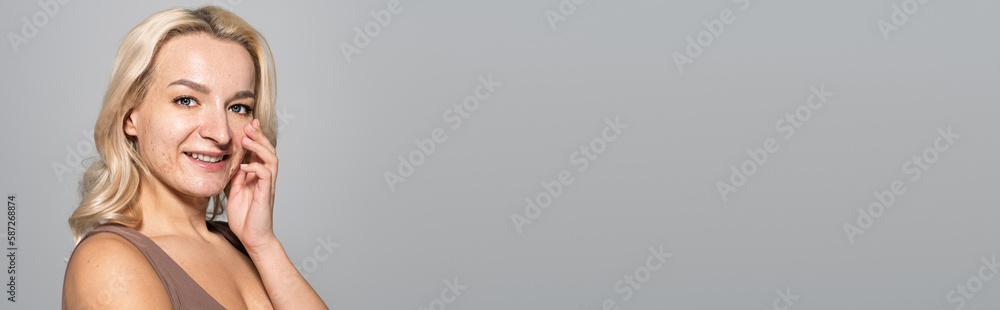 Pretty woman with acne on face touching skin isolated on grey, banner. Pretty woman with acne on face touching skin isolated on grey, banner.