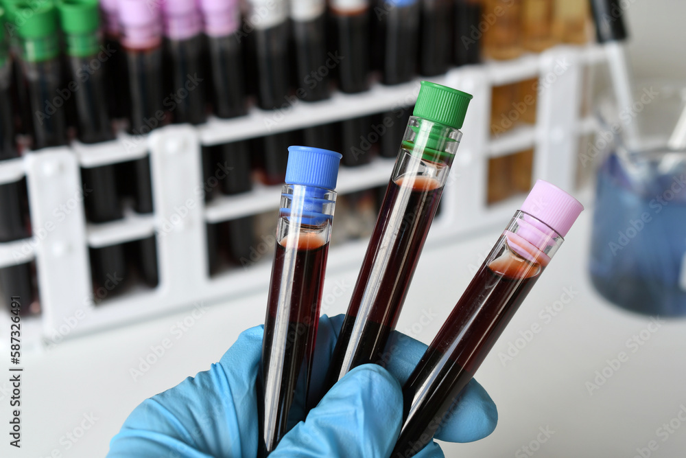 Naklejka premium A medical worker lab technician holding vials of blood for testing