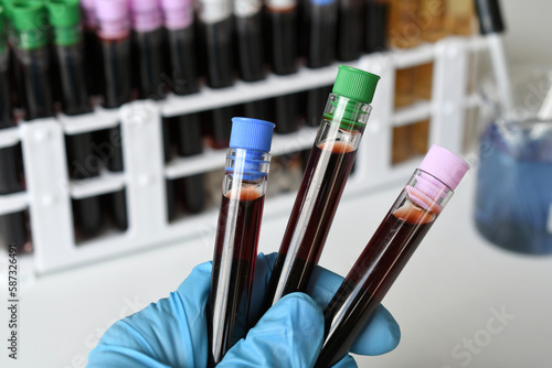 A medical worker lab technician holding vials of blood for testing photo