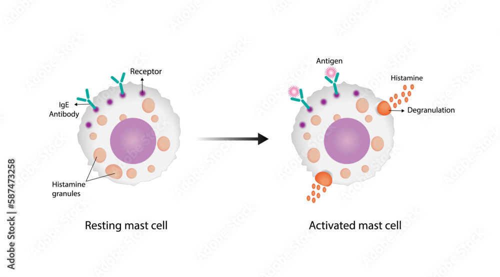 Vetor de Resting and activated mast cell. Anaphylactic, allergic