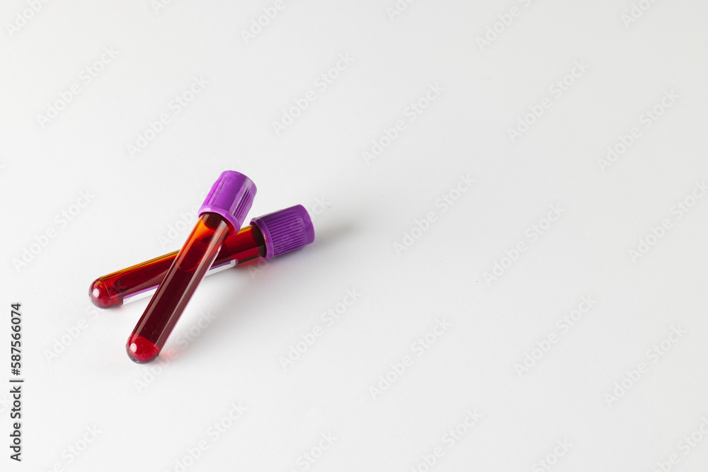 Two blood sample tubes with purple lids, on white background with copy space Two blood sample tubes with purple lids, on white background with copy space