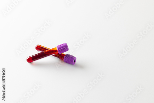 Two blood sample tubes with purple lids, on white background with copy space