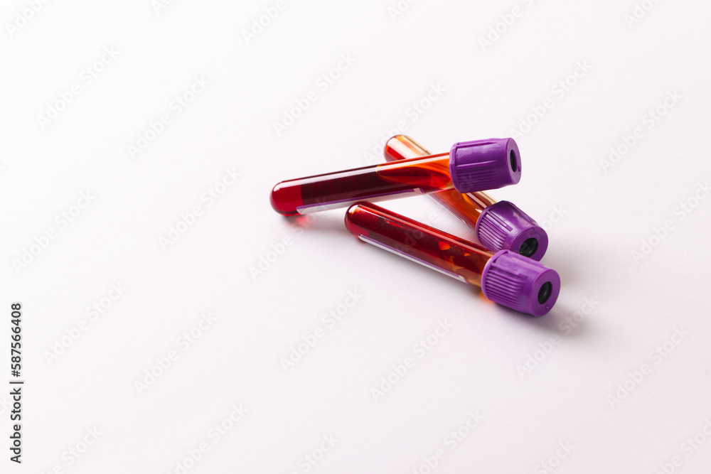 Naklejka premium Three blood sample tubes with purple lids, on white background with copy space