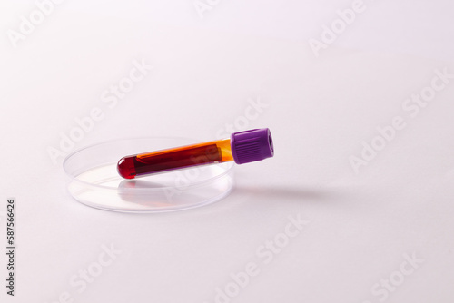 Blood sample tube in petri dish, on white background with copy space