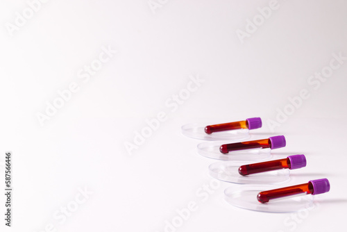 Row of blood sample tubes in petri dishes, on white background with copy space