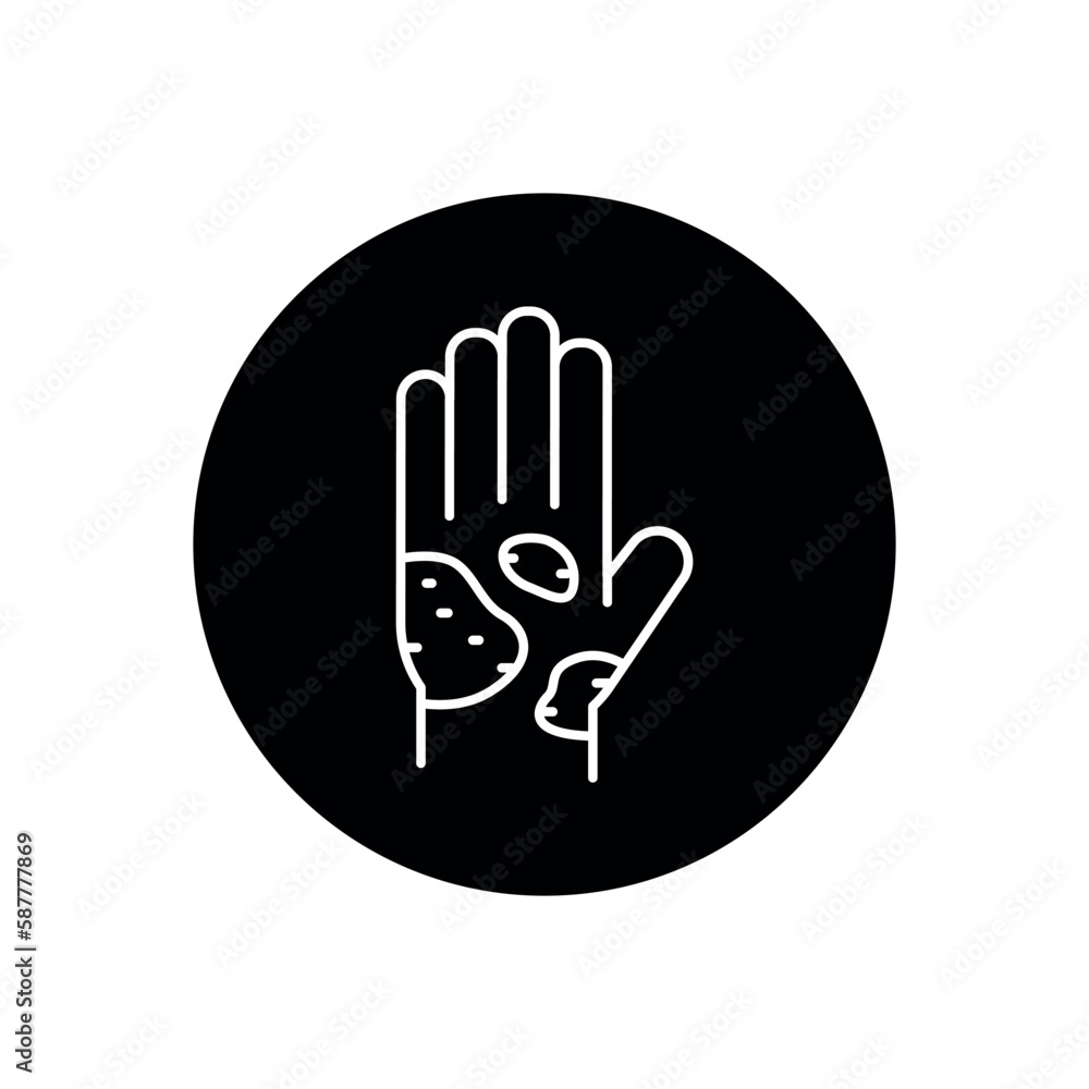 Eczema black line icon. Dermatology disease. Eczema black line icon. Dermatology disease.