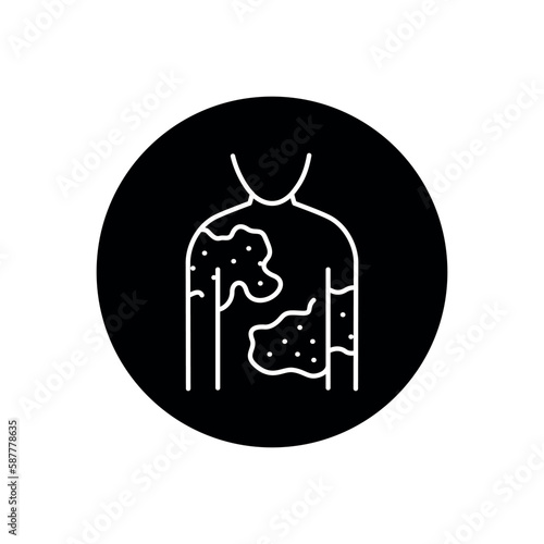 Urticaria black line icon. Dermatology disease.
